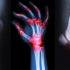 MODERN MALADIES: Are autoimmune diseases like rheumatoid arthritis & multiple sclerosis on rise ?